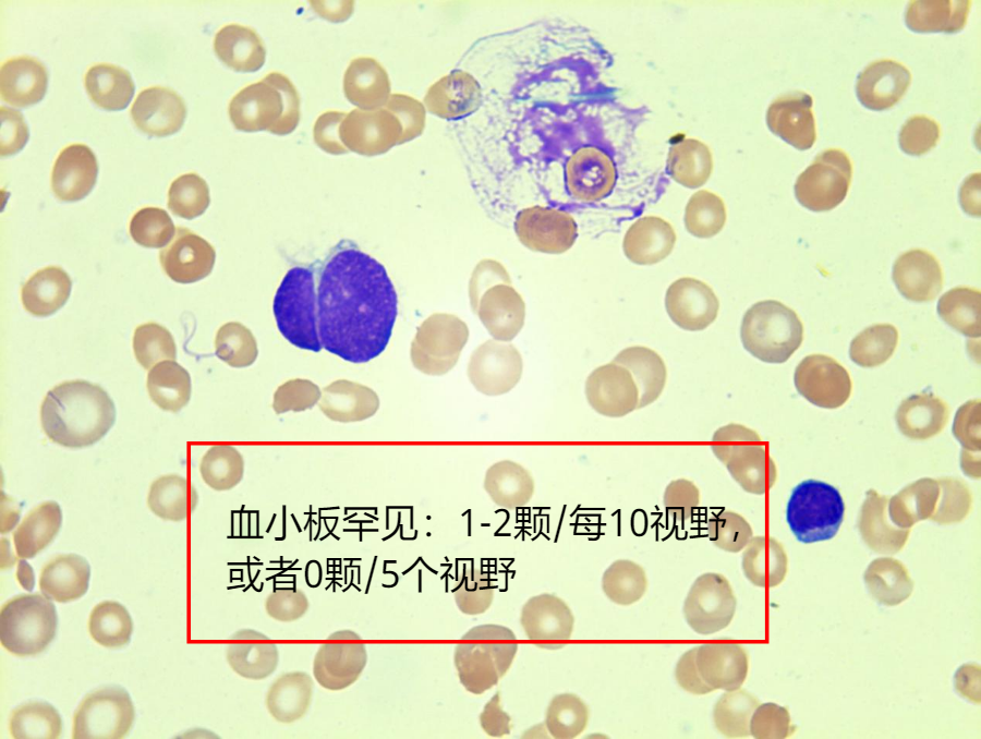 血小板分布宽度187,血小板分布宽度