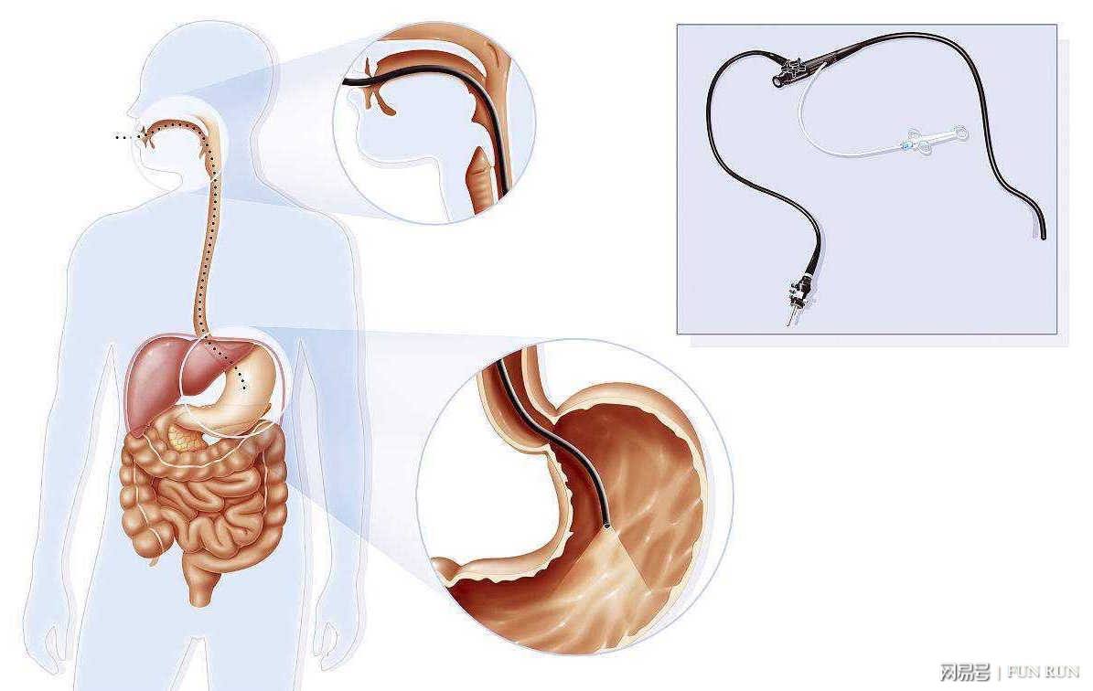 胃镜检查怎么检查,胃镜
