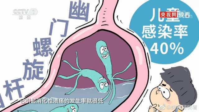 关于宝宝幽门螺旋杆菌感染有哪些症状的信息