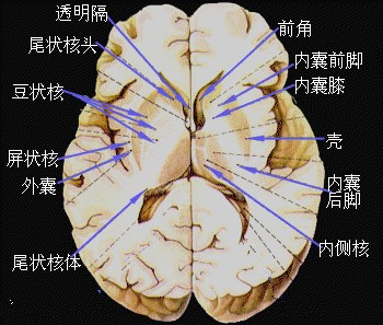 白质和灰质的区别白质