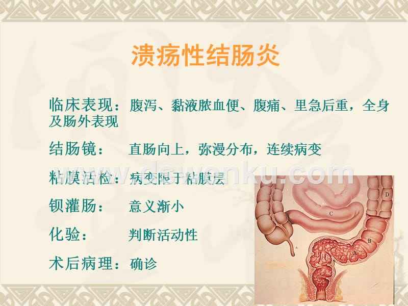 结肠炎是左边痛还是右边痛结肠炎症状