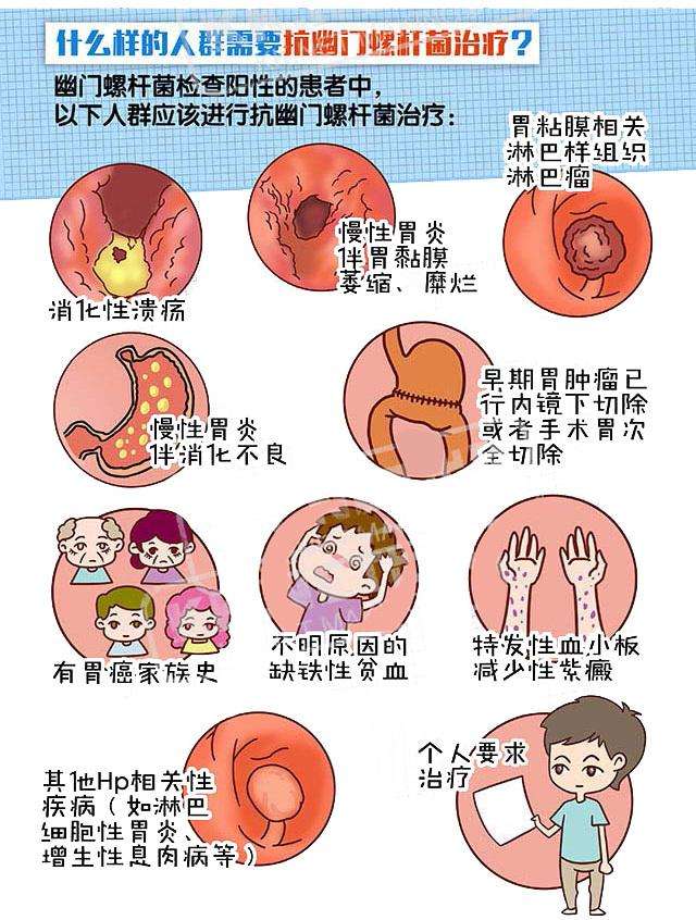 螺旋幽门杆菌的症状传染吗,幽门螺旋杆菌什么症状会传染吗