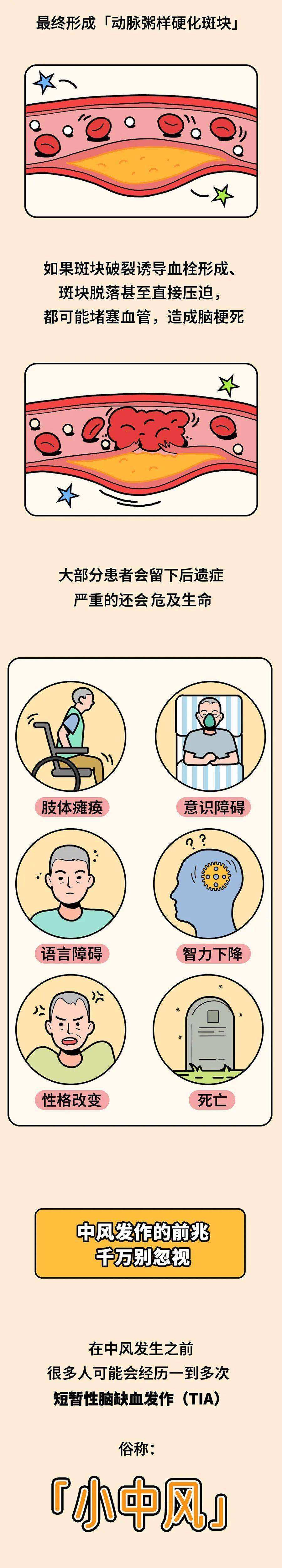 中风中风能治好吗