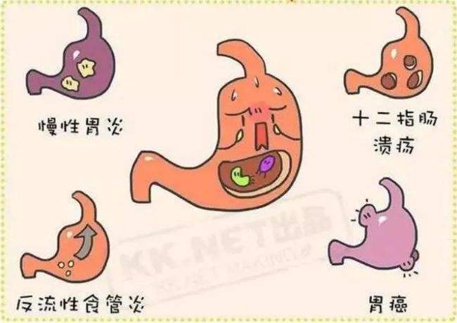 幽门螺旋杆菌阳性接吻会传染吗,幽门螺旋杆菌阳性会通过接吻传染吗