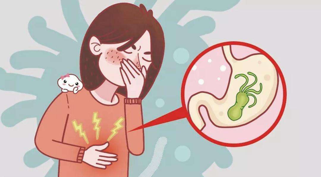 幽门螺旋杆菌的主要症状,幽门螺杆菌感染有什么症状