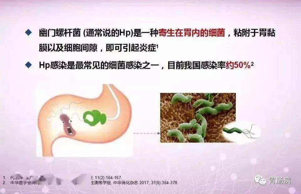 幽门螺旋杆菌有哪些症状男人得幽门螺旋杆菌有哪些症状