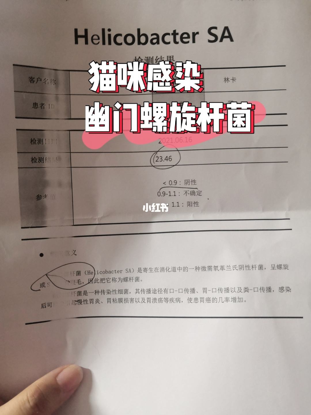 幽门螺旋杆菌阳性是什么病会传染吗幽门螺旋杆菌阳性是什么病