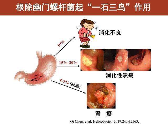 关于幽门螺杆菌阳性到底要不要治疗的信息