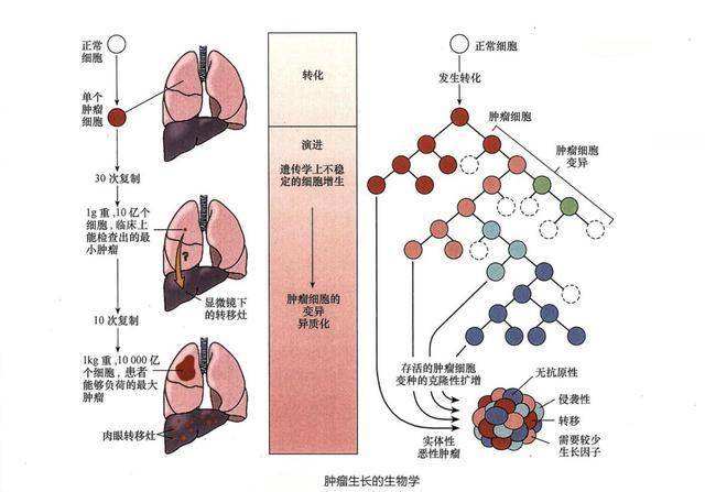 恶性肿瘤特异生长因子恶性肿瘤特异生长因子能查出什么