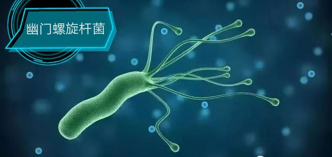 包含幽门螺旋杆菌是什么症状的词条