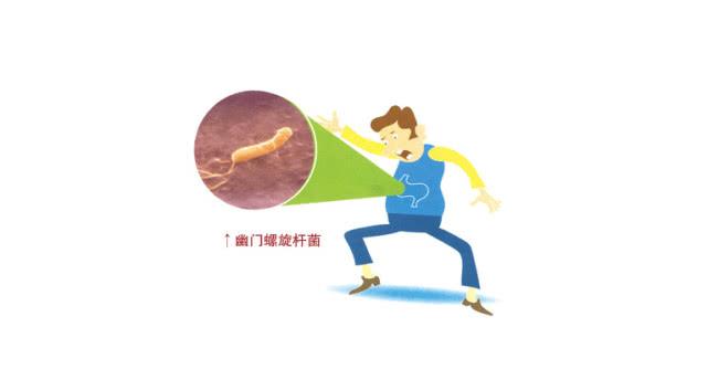 包含幽门螺旋杆菌是什么症状的词条