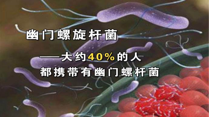 幽门螺旋杆菌最好的治疗方法时间的简单介绍
