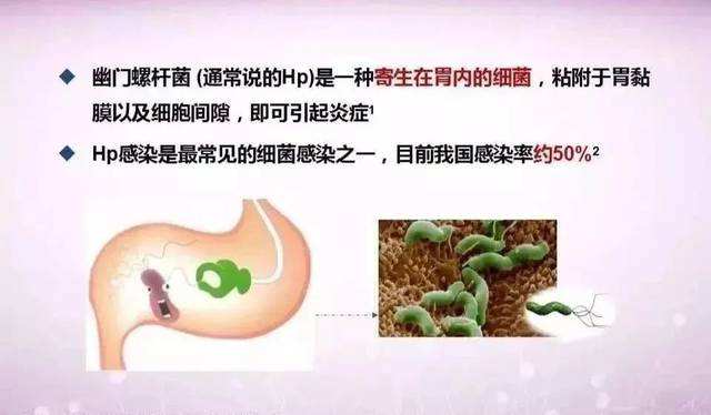 幽门螺旋杆菌感染会导致什么病,幽门螺旋杆菌感染会引起什么疾病