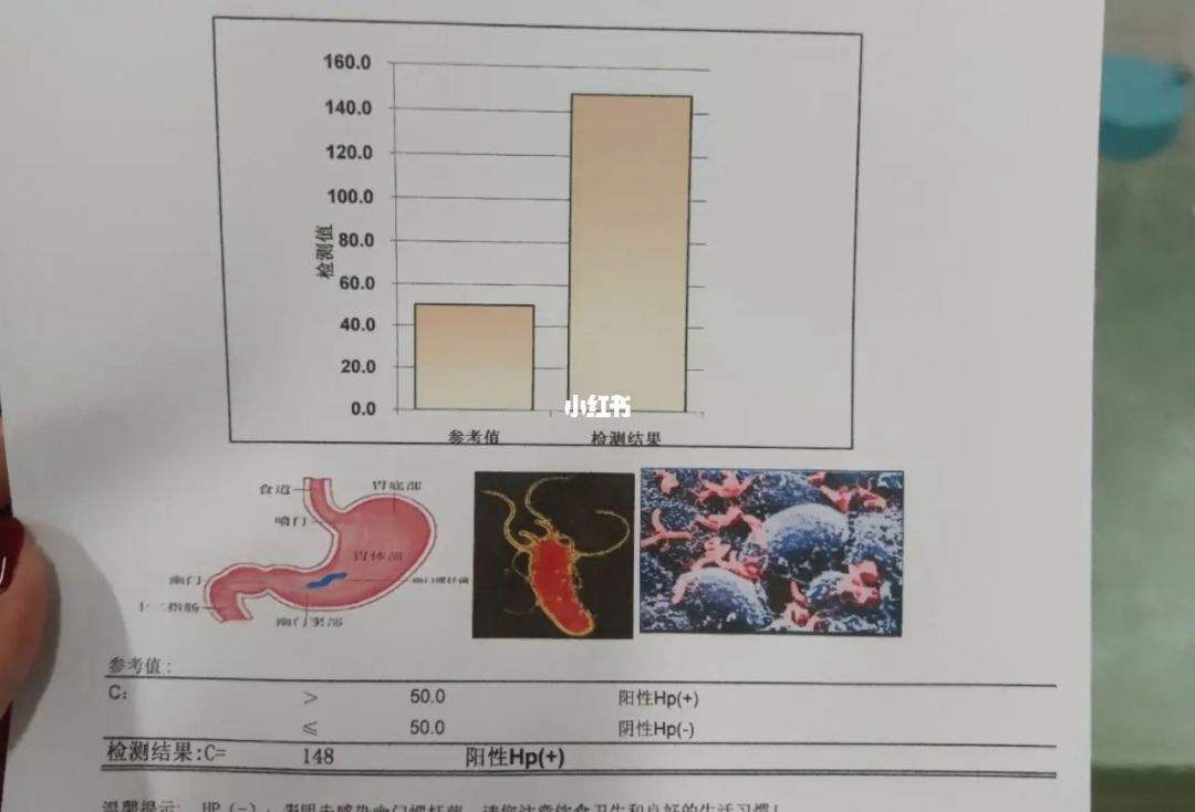 怎样检测幽门螺旋杆菌是否是阳性,幽门螺旋杆菌怎么筛查阳性