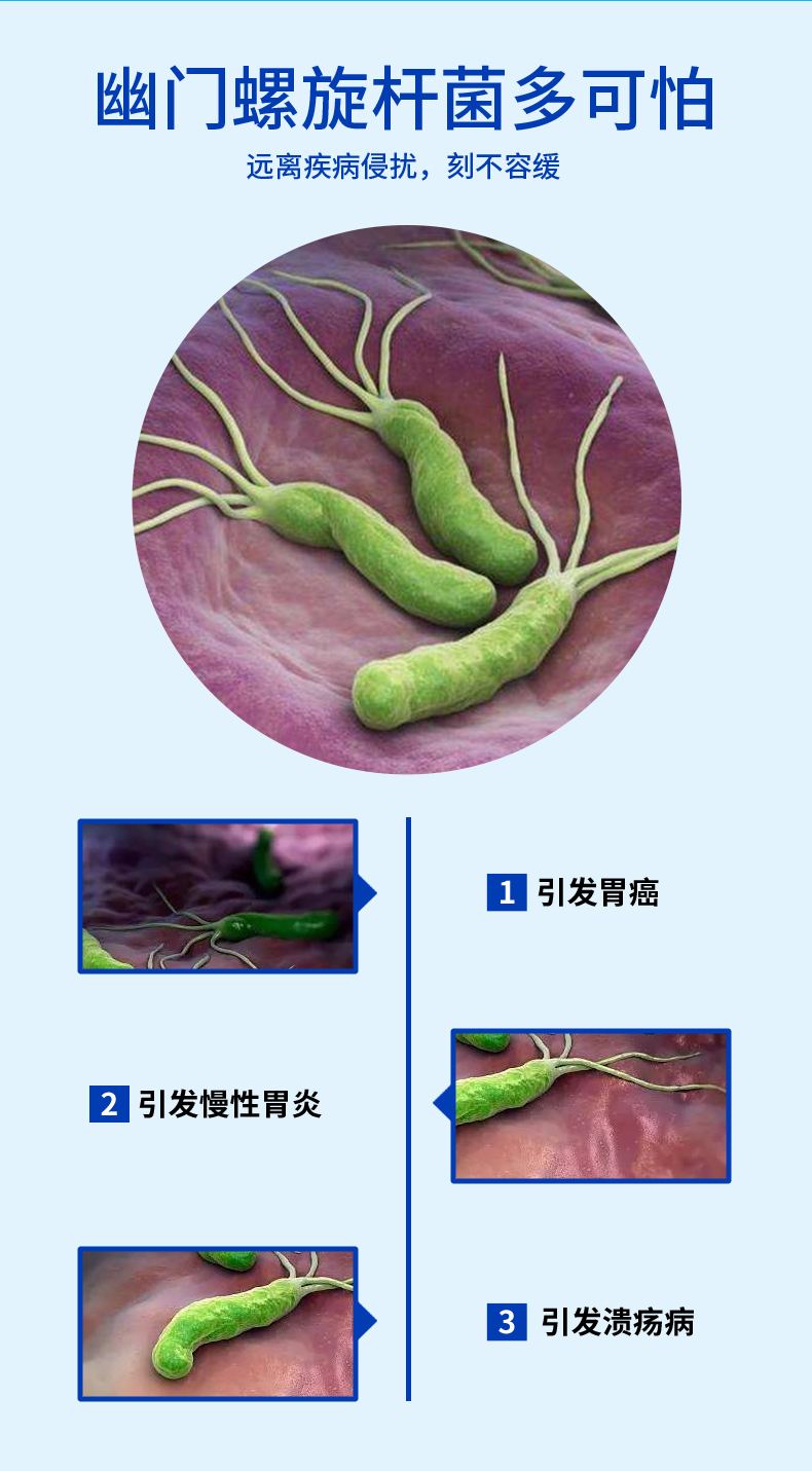 幽门螺旋杆菌感染后多久复查幽门螺旋杆菌感染有哪些症状多长时间复查