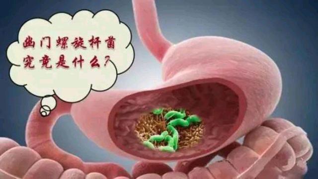 幽门螺旋杆菌是怎么造成的幽门螺旋杆菌是怎么造成的什么原因引起的