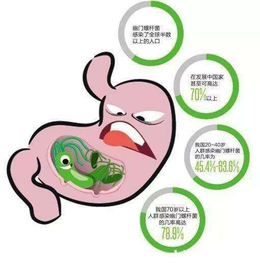 幽门螺旋杆菌怎么能查出来,幽门螺旋杆菌怎么能查出来价格多少