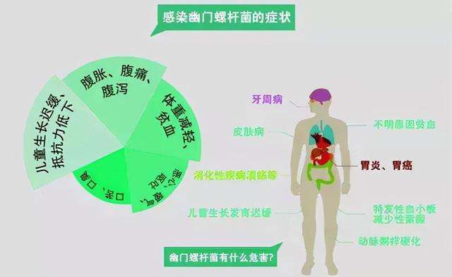 幽门螺旋杆菌治疗好了会复发吗,幽门螺旋杆菌治疗好了会复发吗?