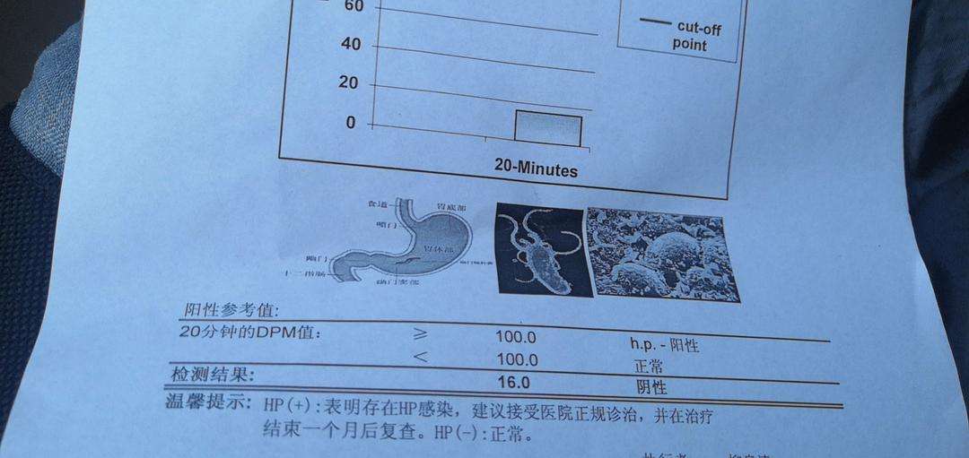 幽门螺杆菌检测值多少正常啊幽门螺杆菌检测值多少正常