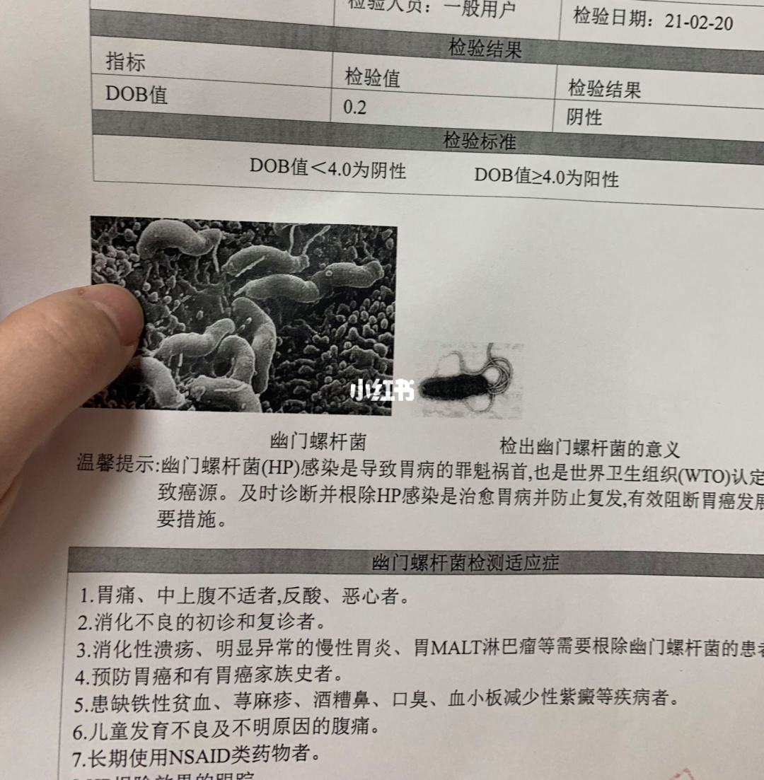 幽门螺旋杆菌呈阳性怎么办严重吗幽门螺旋杆菌呈阳性怎么办严重吗会传染吗