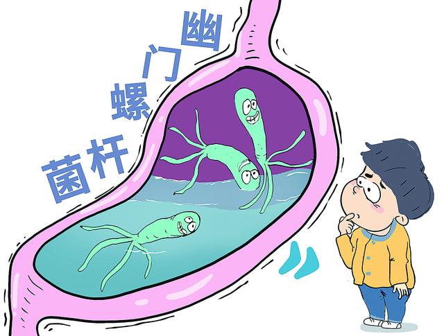 幽门螺杆菌成阳性必须治疗吗幽门螺旋杆菌阳性都需要治疗吗