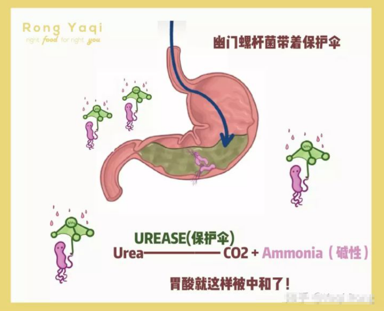 幽门螺旋杆菌筛查幽门螺旋杆菌筛查查什么