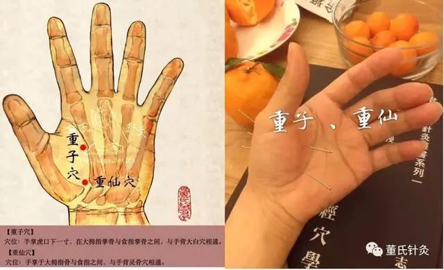 鬼邪为什么怕针灸鬼邪针法是真的吗?