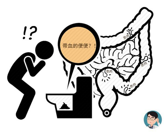 怎么区分痔疮出血和肠道出血,如何辨别是痔疮出血还是肠道出血