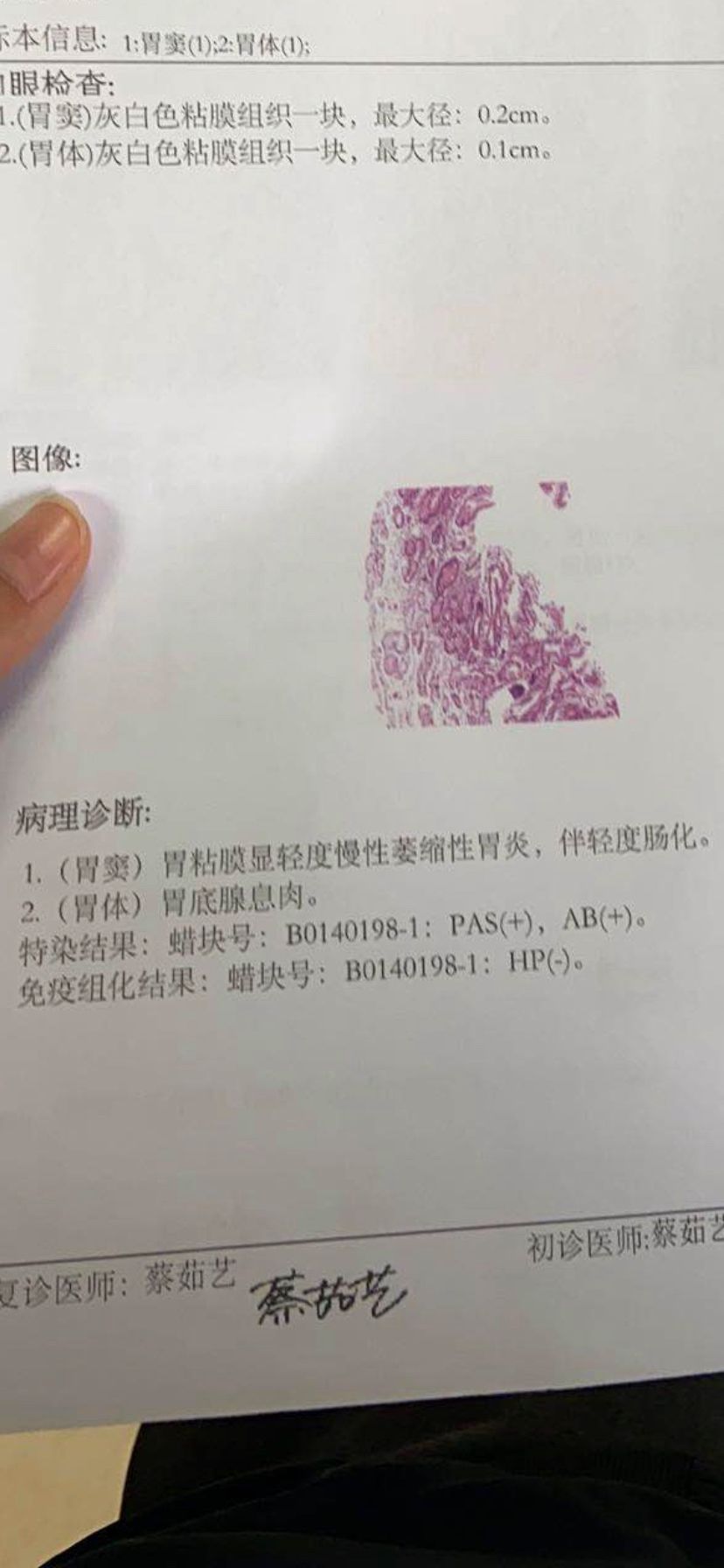慢性非萎缩性胃炎是什么意思,慢性萎缩性胃炎吃什么药可以根治