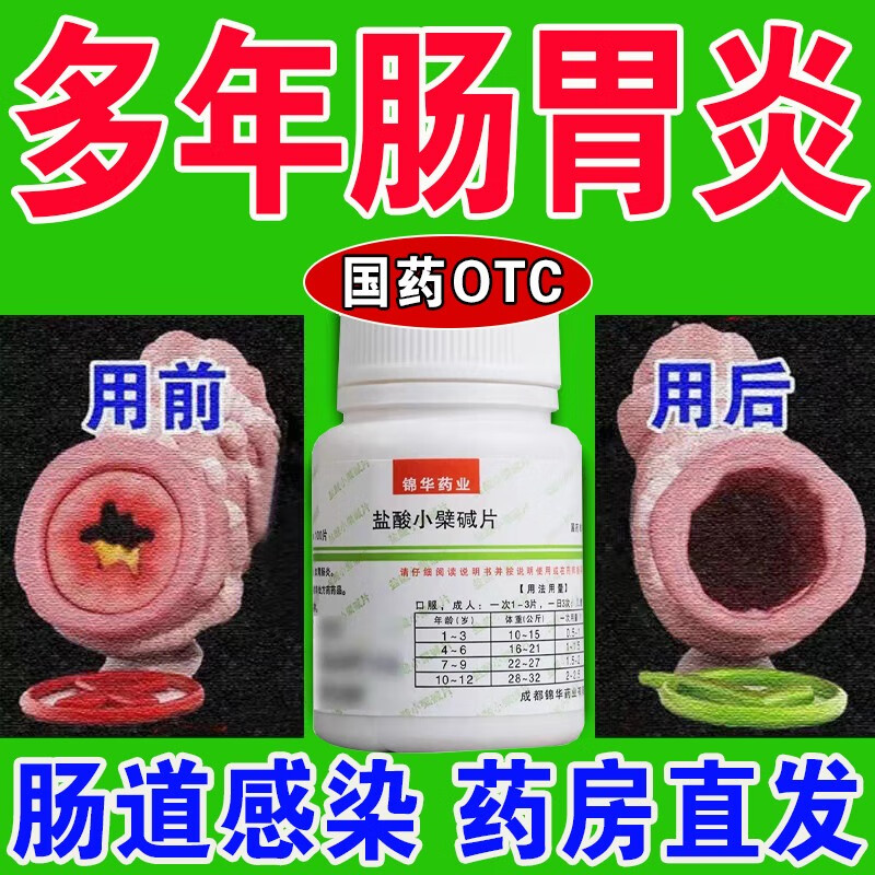 急性肠炎吃什么药,急性肠炎吃什么药