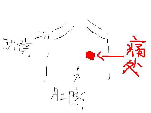 肚脐周围疼是怎么回事,肚脐周围疼是怎么回事放了屁就舒服