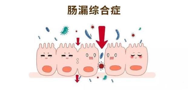 肠痉挛症状痉挛吃什么药效果好