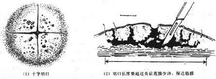软组织感染软组织感染用什么药