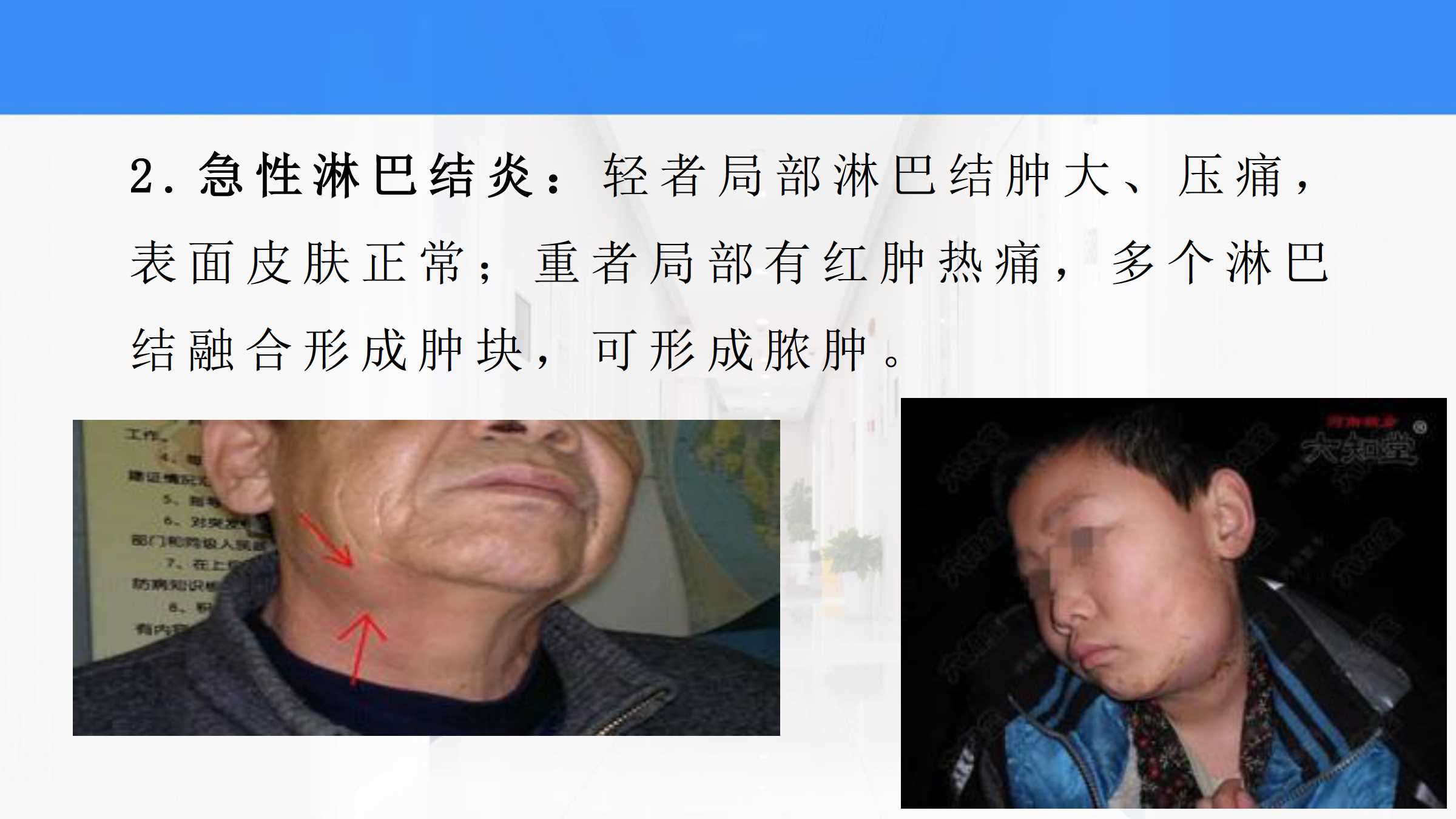 软组织感染软组织感染用什么药