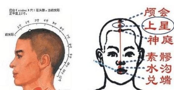 鬼门十三针位置图片大全,鬼门十三针位置图片