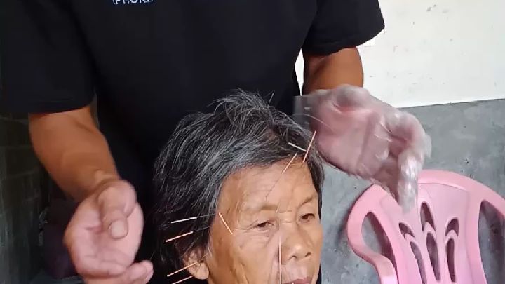 正常人扎鬼门十三针,哪里能扎鬼门十三针