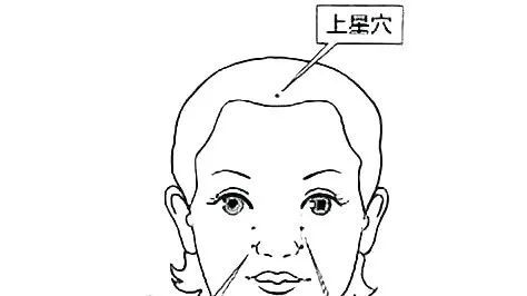 鬼门十三针治精神病哪家医院好,鬼门十三针的真实案例
