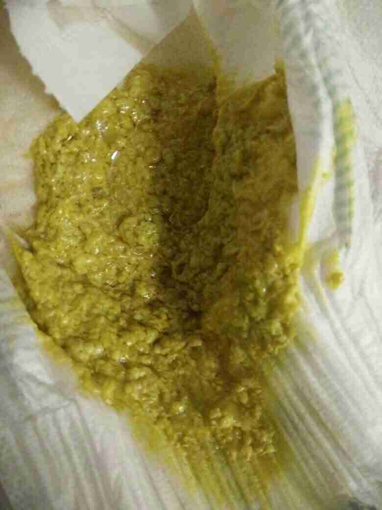 大便先干后稀用什么中成药大便先干后稀 大便先干后稀用什么中成药大便先干后稀