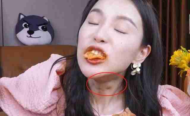 催吐催吐会瘦吗 催吐催吐会瘦吗